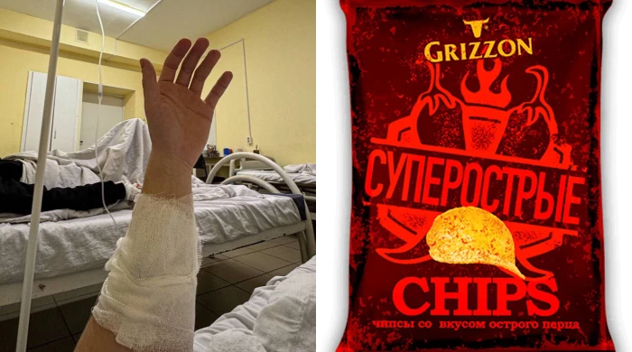 Молодой человек из Ярославля получил серьёзные травмы.