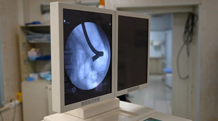 Попытки протолкнуть её не дали результата, поэтому врачам пришлось разрезать сосиску.