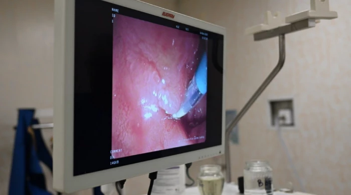 В больнице выяснилось, что сосиска застряла между пищеводом и желудком.