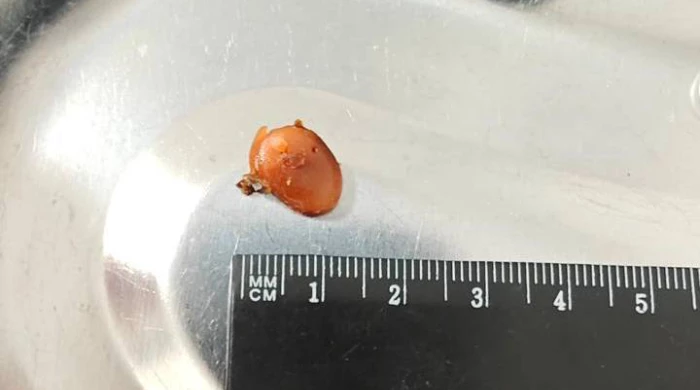 Мужик оглох на одно ухо из-за болтливых коллег на работе